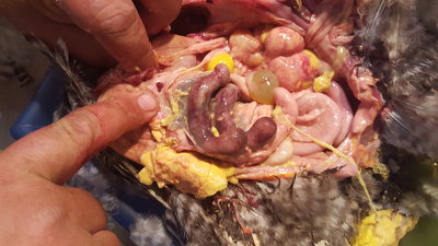 .?  Egg peritonitis
