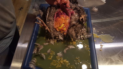 Fluid - ? Ascites